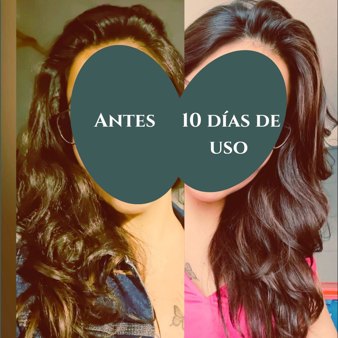 Acondicionador H-Intensidad Baja - Imagen 4