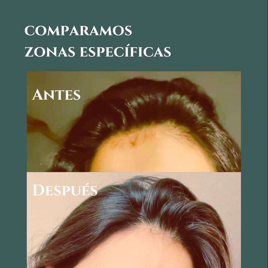 Shampoo Suave - Imagen 2